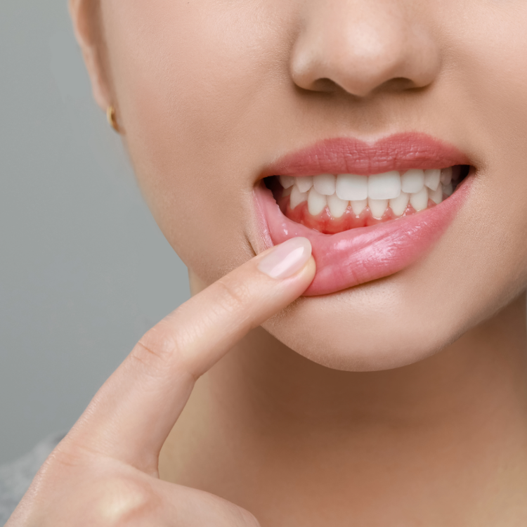 Sensitive Teeth