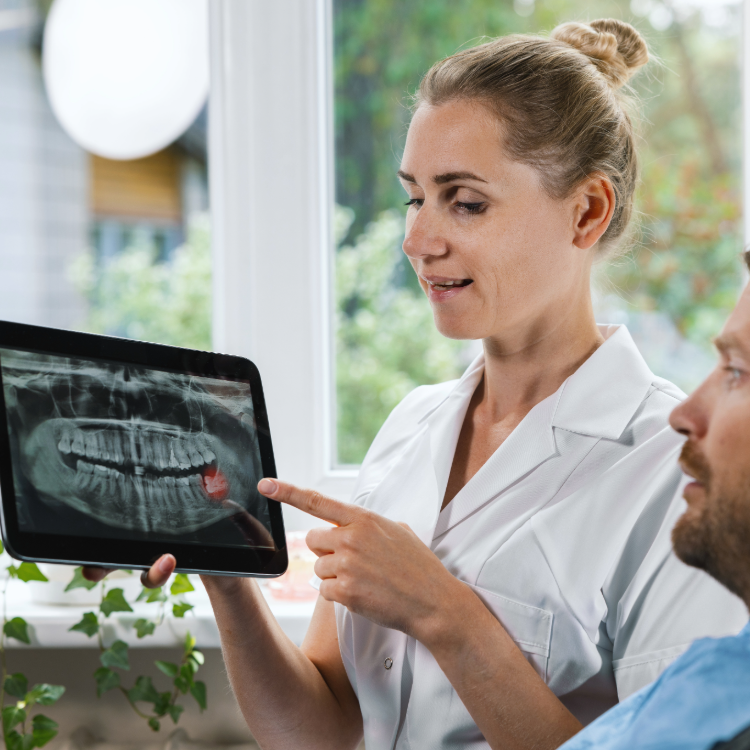 Impacted Wisdom Teeth