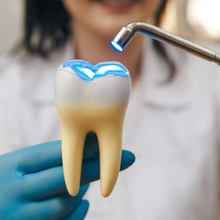 Broken dental Filling